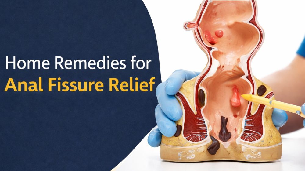 Home Remedies for Anal Fissure Relief