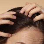 Home Remedies for Itchy Scalp: 10 Natural Ways to Stop the Itch Fast