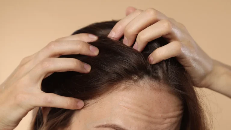 home remedies for itchy scalp​