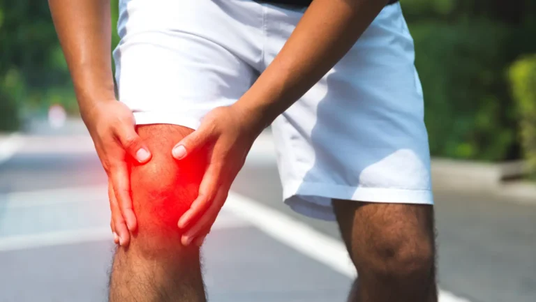 Home Remedies for Knee Pain: 15 Safe and Effective Ways to Relieve Discomfort Naturally