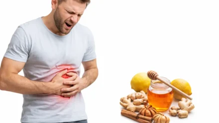 Home Remedies for Ulcers: 10 Natural Ways to Support Stomach Healing