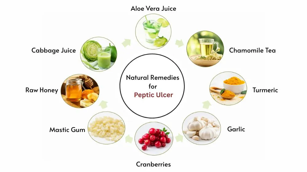 Natural Remedies for Peptic Ulcer