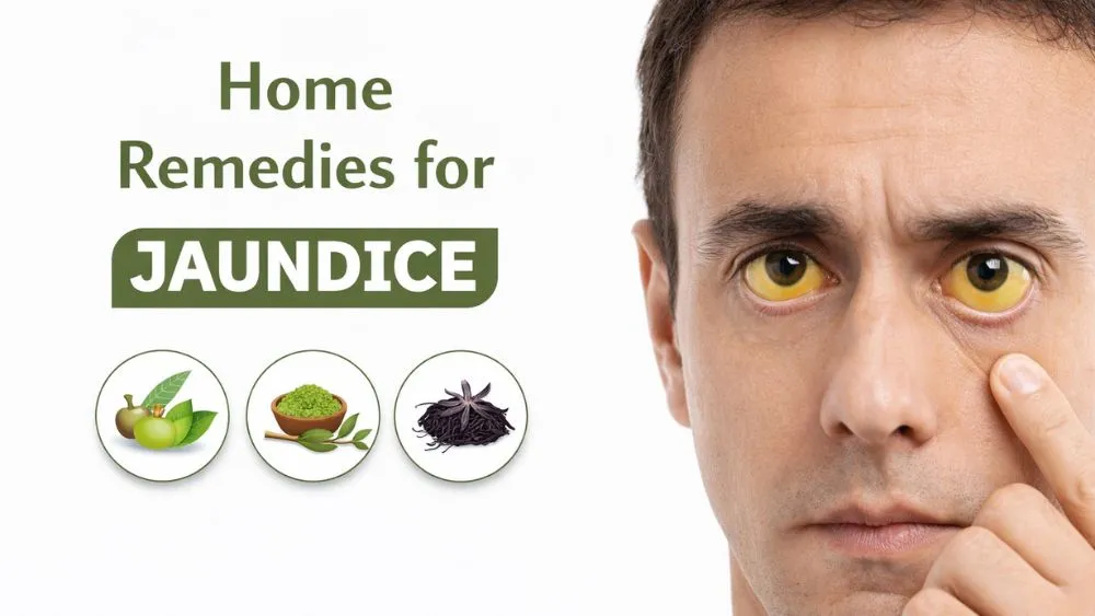 Home Remedies for Jaundice