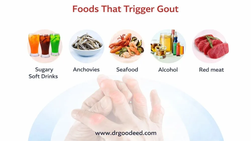 Foods That Trigger Gout 