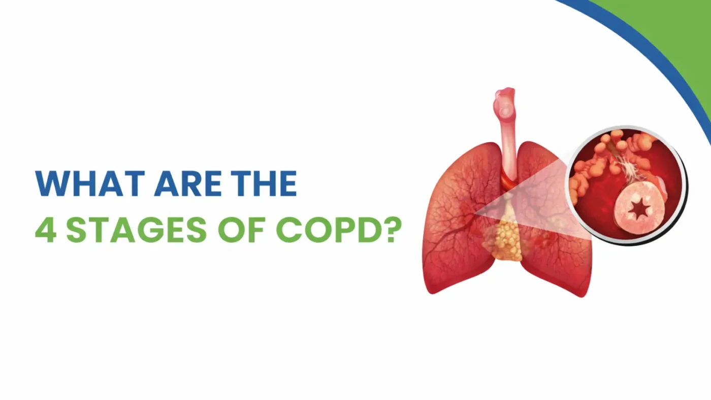 What Are the 4 Stages of COPD? Symptoms, Progression & Treatment