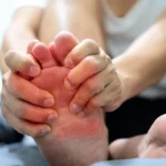 How to Stop Gout Pain at Night: Fast Relief and Sleep Tips