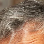 Can Stress Cause Gray Hair? Science, Causes, and Prevention