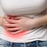 Can Stress Cause Kidney Stones? Causes, Risk Factors, and Prevention