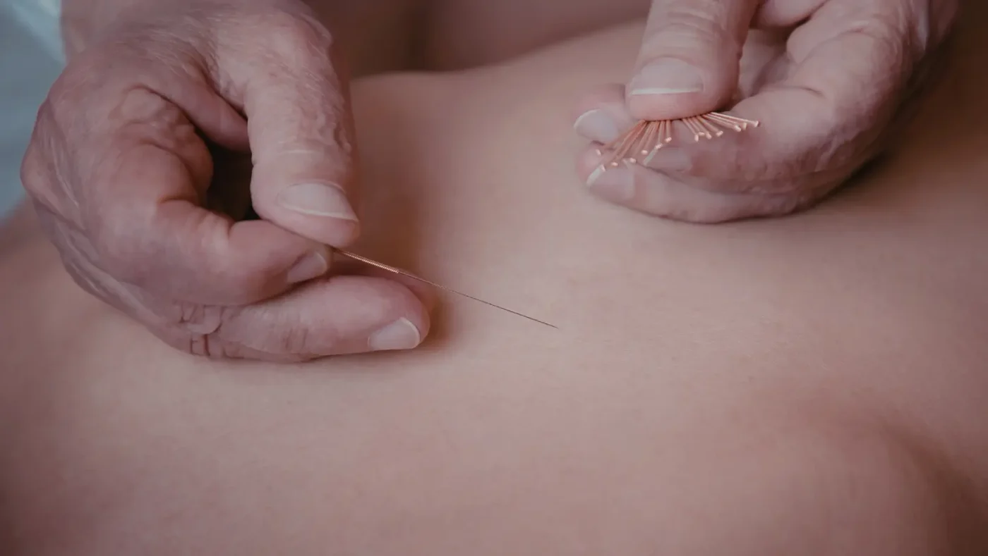 Disadvantages of Acupuncture: Side Effects, Risks & What to Know 5 Disadvantages of Acupuncture: Side Effects, Risks & What to Know