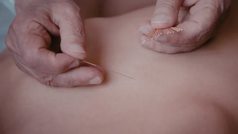 Disadvantages of Acupuncture: Side Effects, Risks & What to Know 33 disadvantages of acupuncture
