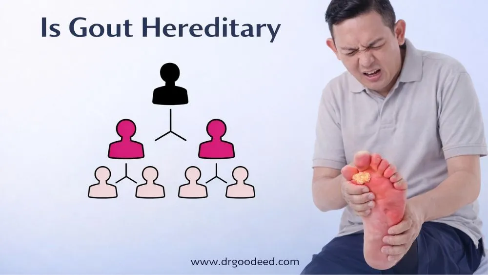 Is Gout Hereditary