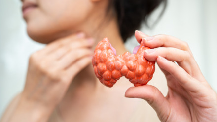 Hyperthyroidism