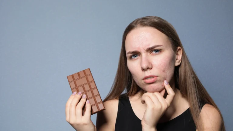 Does Chocolate Cause Acne? Understanding the Link Between Diet and Breakouts