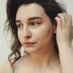 Does Smoking Weed Cause Acne? Cannabis, Skin Health, and Breakouts Explained