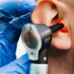 Types of Ear Infections: Symptoms, Causes, and Treatment Options