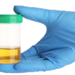 Pee Appears Cloudy: Causes, Symptoms, and When to Worry