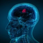 Early Signs of Brain Tumor: Symptoms, Warning Signs, and When to Seek Medical Care