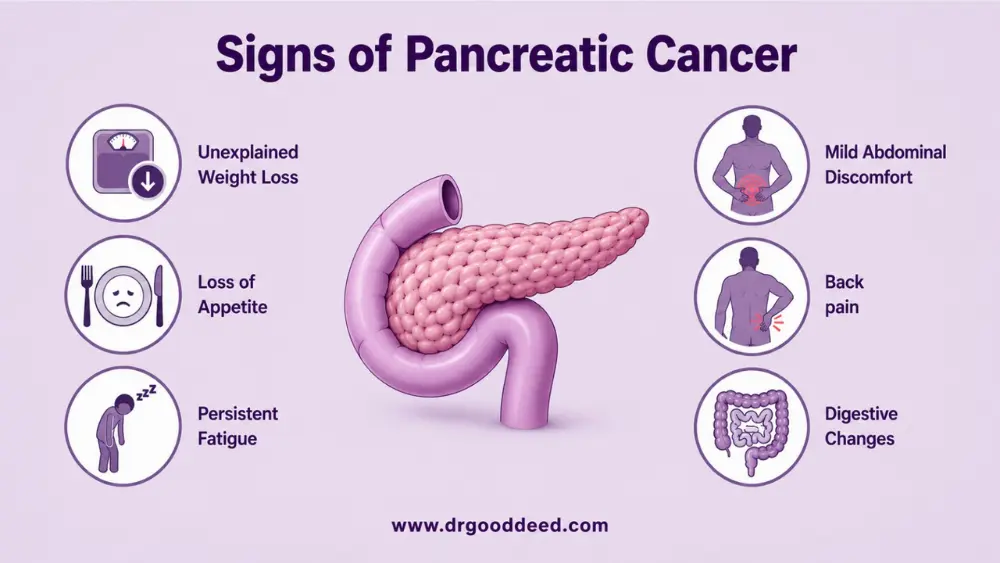 Early Signs of Pancreatic Cancer