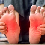 Home Remedies for Burning Feet: Natural Ways to Relieve Foot Burning and Tingling
