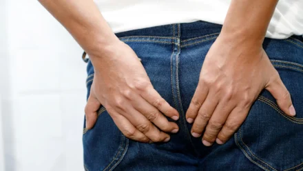 Can Thongs Cause Hemorrhoids? Understanding Friction, Irritation, and Underwear Choices