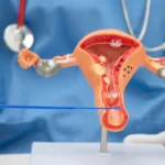 Can Women Get Prostate Cancer? Understanding the Female Prostate and Rare Cancer Risks
