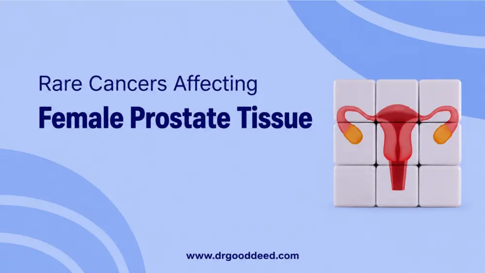 Rare Cancers Affecting Female Prostate Tissue