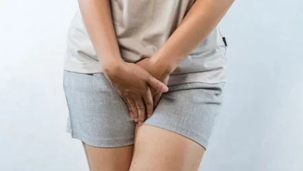 Home Remedies for Yeast Infections: Safe Relief Tips and Prevention Strategies