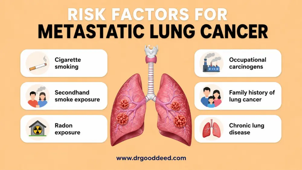 Risk Factors for Metastatic Lung Cancer