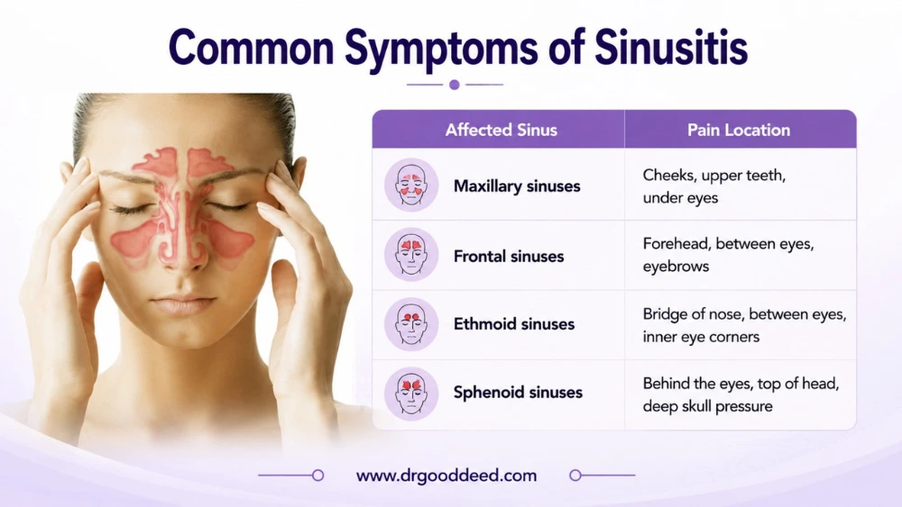 Common Symptoms of Sinusitis