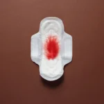 Are Blood Clots During Periods Normal? Causes, Symptoms, and When to Worry