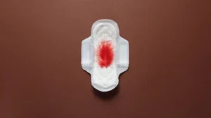 Are Blood Clots During Periods Normal