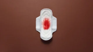 Are Blood Clots During Periods Normal? Causes, Symptoms, and When to Worry