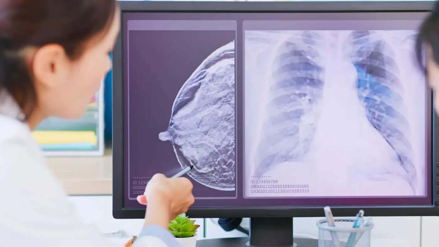 Signs of Breast Cancer in Women: Early Warning Symptoms You Should Never Ignore 5 Signs of Breast Cancer in Women: Early Warning Symptoms You Should Never Ignore