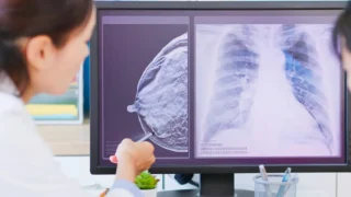 Signs of Breast Cancer in Women: Early Warning Symptoms You Should Never Ignore
