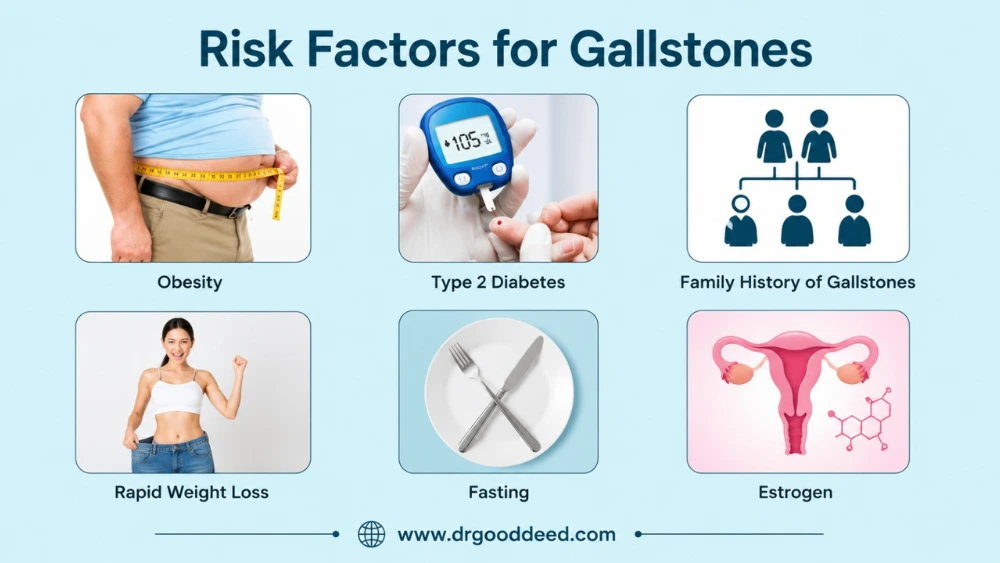 Risk Factors for Gallstones