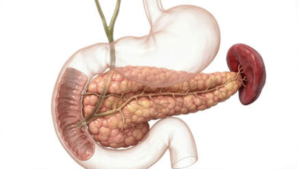 Can You Live Without Pancreas? What to Expect After Pancreas Removal