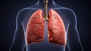 Can You Live With One Lung? Understanding Life After Lung Removal