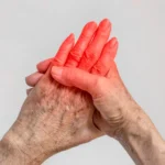 Symptoms of Arthritis in Hands: Early Signs, Causes, and Ways to Find Relief