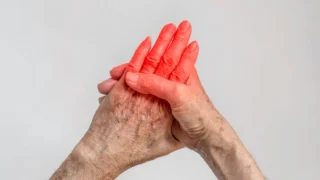 Symptoms of Arthritis in Hands: Early Signs, Causes, and Ways to Find Relief