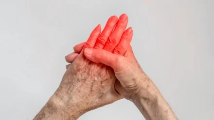 Symptoms of Arthritis in Hands: Early Signs, Causes, and Ways to Find Relief