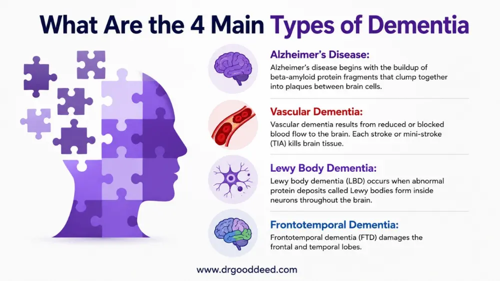 4 Main Types of Dementia