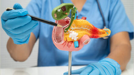 Bile Duct Obstruction: Causes, Symptoms, and Treatment Options