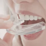 Best Mouth Guard for Sleep Apnea: How Oral Appliances Help Reduce Snoring and Improve Sleep