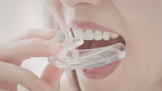 Best Mouth Guard for Sleep Apnea: How Oral Appliances Help Reduce Snoring and Improve Sleep