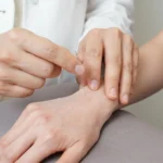 What Are the 4 Stages of Rheumatoid Arthritis? A Complete Guide to Disease Progression