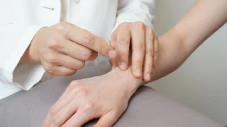 What Are the 4 Stages of Rheumatoid Arthritis? A Complete Guide to Disease Progression