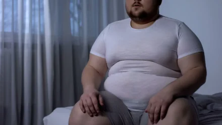 Does Sleep Apnea Cause Weight Gain? Understanding Metabolism, Hormones, and Weight Loss Challenges