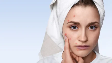 How to Reduce Skin Aging: Effective Ways to Keep Your Skin Youthful