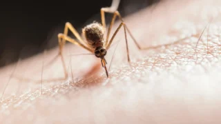 Home Remedies for Mosquito Bites: 10 Natural Ways to Relieve Itching