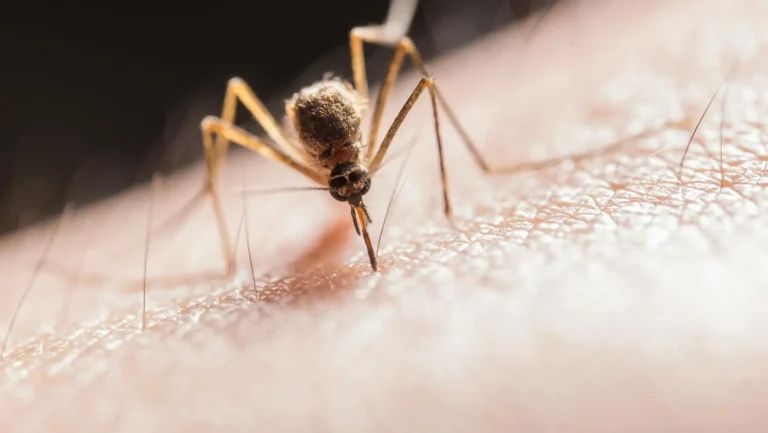 Home Remedies for Mosquito Bite